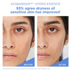 AESTURA ATOBARRIER365 Hydro Essence with Hydrating Amino Acids | Lightweight Formula, Deep Hydration, Suitable for Dry & Sensitive Skin, Non-Comedogenic, 200ML / 6.76 fl. oz.
